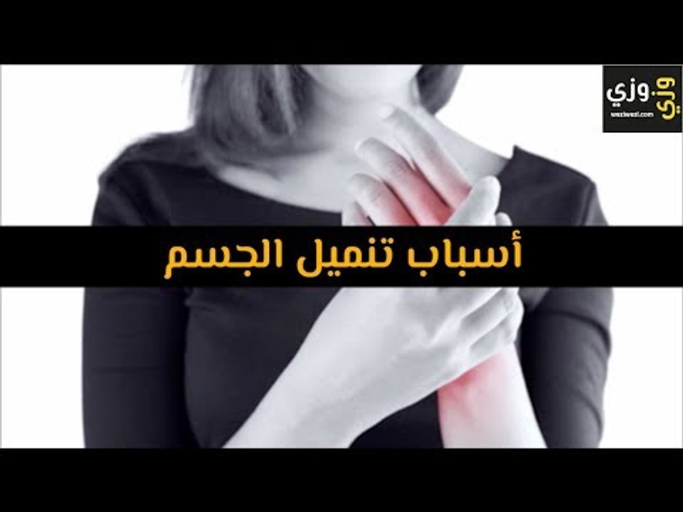 أهم أسباب تنميل الجسم