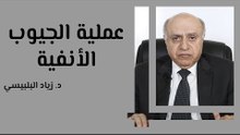 عملية الجيوب الأنفية
