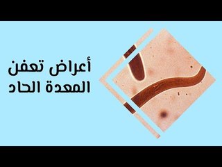 أهم أعراض تعفن المعدة الحاد