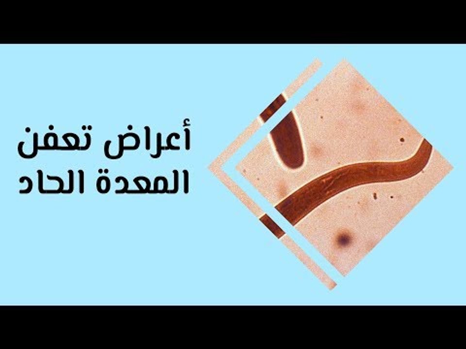 أهم أعراض تعفن المعدة الحاد