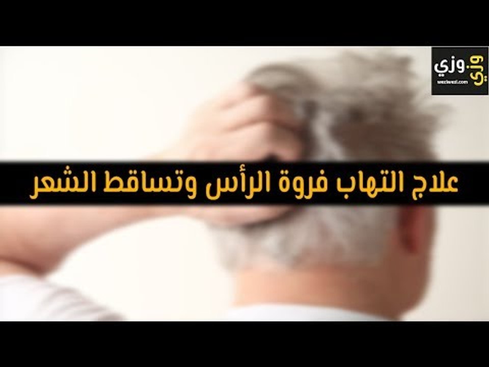 أهم علاج التهاب فروة الرأس وتساقط الشعر