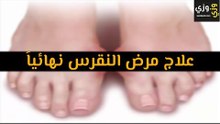أهم علاج مرض النقرس نهائياً