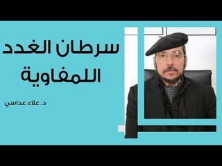 سرطان الغدد اللمفاوية