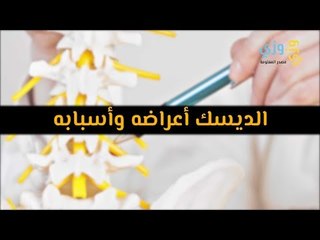 أهم أسباب الديسك وأعراضه