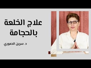 علاج الخلعة بالحجامة