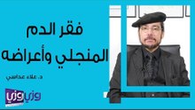فقر الدم المنجلي وأعراضه