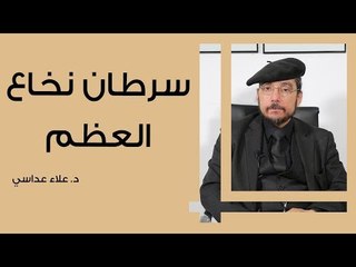 ما هو سرطان نخاع العظم؟ تعرف على الأعراض والعلاج 🩺