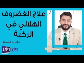 علاج الغضروف الهلالي في الركبة