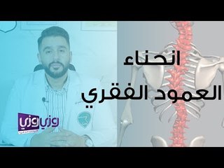 انحناء العمود الفقري