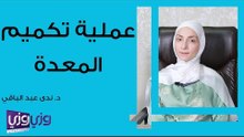 عملية تكميم المعدة