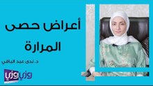 أعراض حصى المرارة