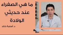 ما هي الصفراء عند حديثي الولادة