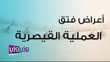 أعراض فتق العملية القيصرية