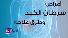 اعراض سرطان الكبد وطرق علاجه