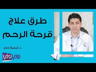 طرق علاج قرحة الرحم
