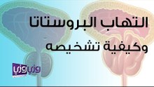 التهاب البروستاتا وكيفية تشخيصه وطريقة علاجه