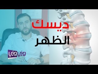 علاج الانزلاق الغضروفي – ديسك الظهر