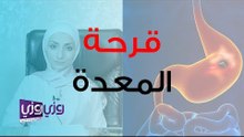 أعراض قرحة المعدة وأسبابها