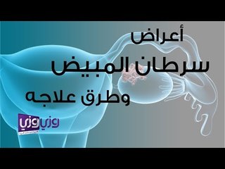 أعراض سرطان المبيض وطرق علاجه
