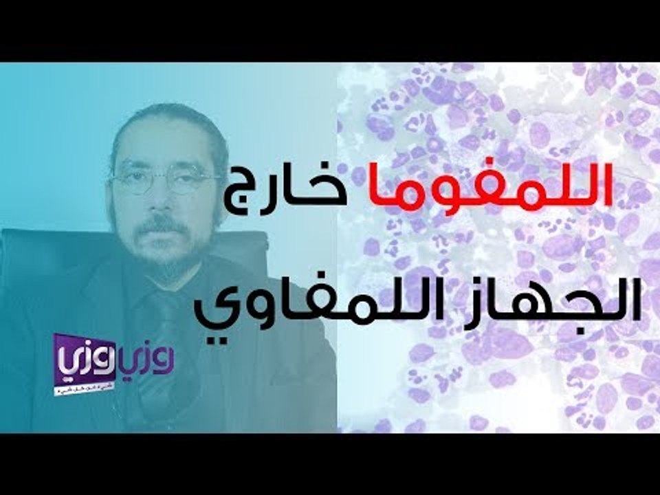 تشخيص وعلاج الليمفوما خارج الجهاز الليمفاوي