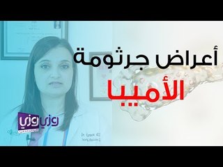 أعراض جرثومة الأميبا وأسبابها