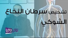 تشخيص سرطان النخاع الشوكي وطريقة علاجه