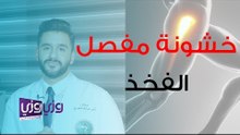 أسباب احتكاك مفصل الفخذ