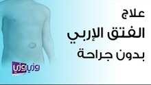 علاج الفتق الإربي بدون جراحة