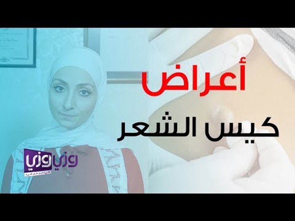 أعراض كيس الشعر