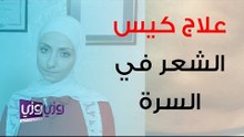 علاج كيس شعر في السرة