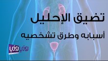 تضيق الإحليل أسباب وطرق تشخيصه