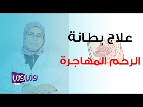 علاج بطانة الرحم المهاجرة