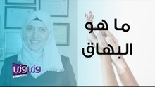 ما هو البهاق وما هي أنواعه؟