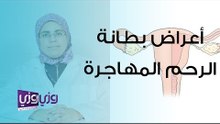 أعراض بطانة الرحم المهاجرة