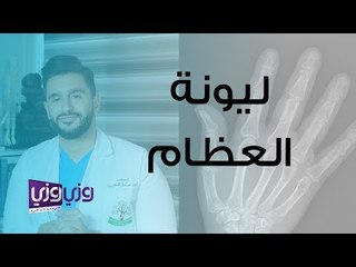 تعرف على لين العظام وأسبابه وكيفية علاجه 🦴