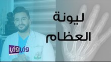 ما هو لين العظام