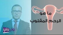 ما هو الرحم المقلوب وهل يحتاج إلى علاج؟