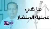 عمليات المنظار تعريفها وأهميتها