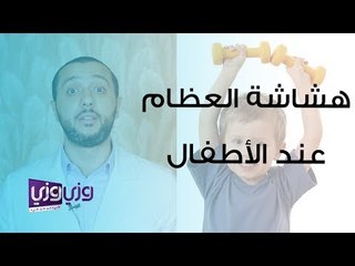 هشاشة العظام عند الأطفال