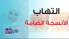 أعراض التهاب الأنسجة الضامة وعلاجها