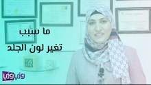 ما سبب تغير لون الجلد