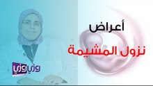 أعراض نزول المشيمة