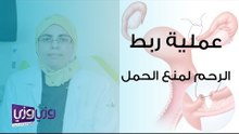 عملية ربط الرحم لمنع الحمل