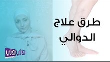 الخيارات المتاحة في علاج الدوالي