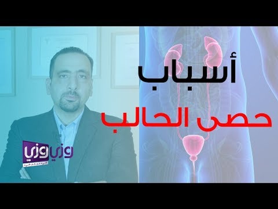 أسباب حصى الحالب