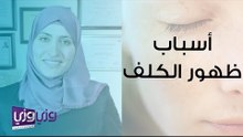 أسباب ظهور الكلف