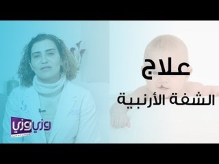 علاج الشفة الأرنبية وفتحة سقف الحلق