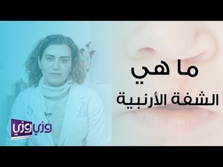 ما هي الشفة الأرنبية