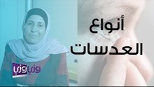 أنواع العدسات اللاصقة وأضرارها
