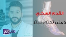القدم السكرى ومتى تحتاج إلى بتر؟